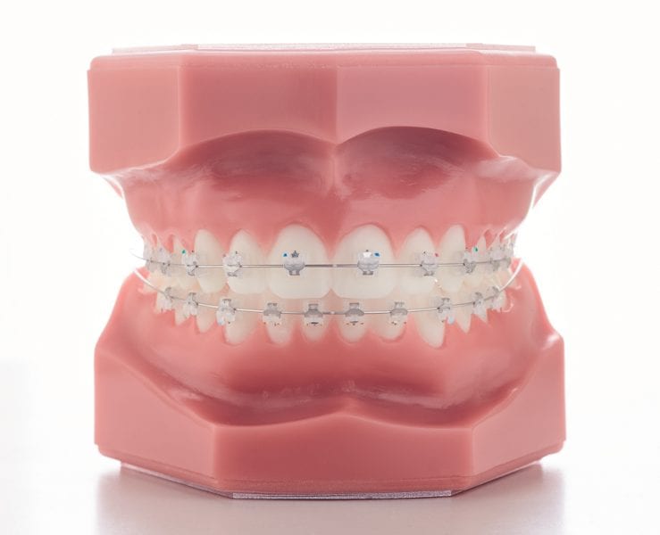 GC ORTHODONTICS • Marrodent