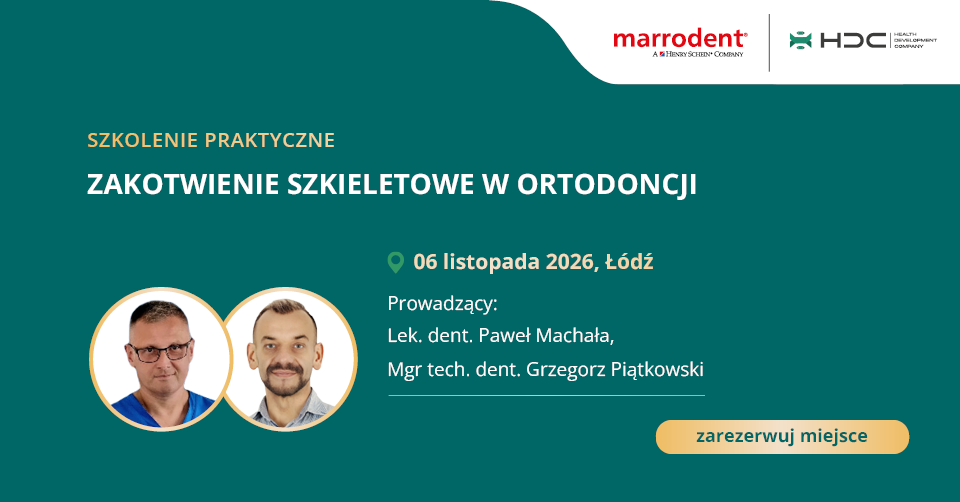 zakotwienie